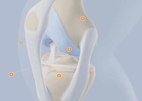 Medical 3D Illustration<br>By Swiss National Accident Insurance Fund