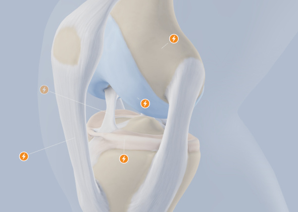 Medical 3D Illustration<br>by Swiss National Accident Insurance Fund